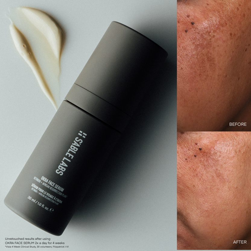 S'ABLE Labs Skincare | Melanin-Inclusive Skincare